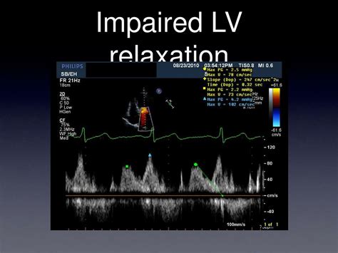 impaired lv relaxation